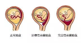 1576199244181187.jpg news-4_看图王.web.jpg